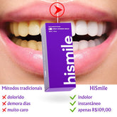 Clareamento Dental Completo com HiSmile